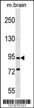PCDHGC5 Antibody (Center)