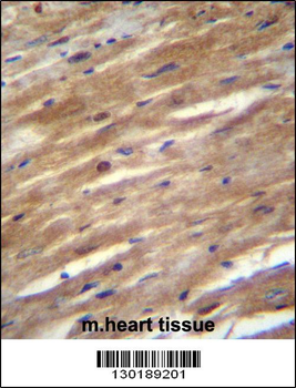 FSD2 Antibody (N-term)