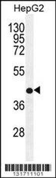 RDH13 Antibody (Center)