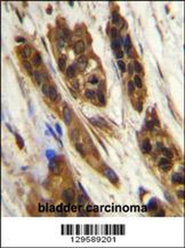 SNR27 Antibody (Center)
