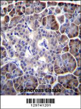 MYBPHL Antibody (N-term)