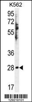 HSD11B1L Antibody (C-term)