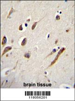 FBXW11 Antibody (Center)