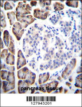 UROC1 Antibody (Center)