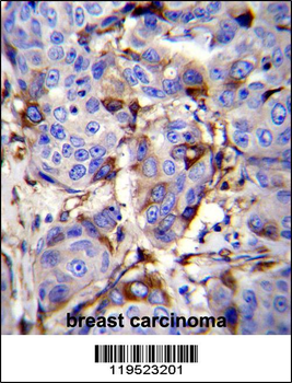 GCDFP-15 Antibody (C-term)