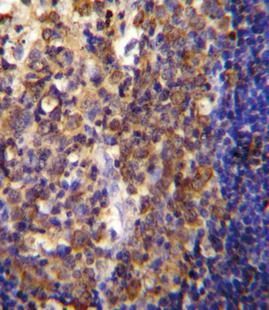 His6-DEP-1 Antibody