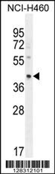 RAB3IL1 Antibody (C-term)