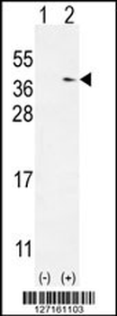 TXNDC6 Antibody (Center)