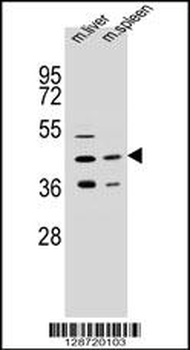 AWAT2 Antibody (C-term)