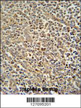 ZN180 Antibody (N-term)