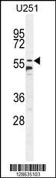 CCDC9 Antibody (N-term)
