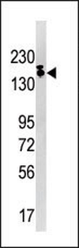 SETDB1 Antibody (C-term)