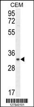 IFTAP Antibody (C-term)