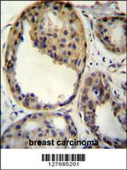 AKT1 (Thr308) Antibody