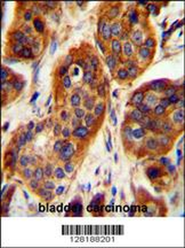 LRRC57 Antibody (C-term)