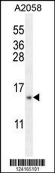 MRPS24 Antibody (Center)