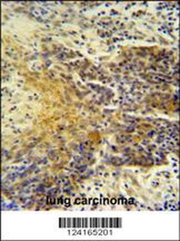 MRPS24 Antibody (Center)