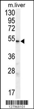 UGT3A2 Antibody (C-term)