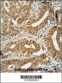 CCDC123 Antibody (C-term)