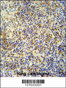KRI1 Antibody (N-term)