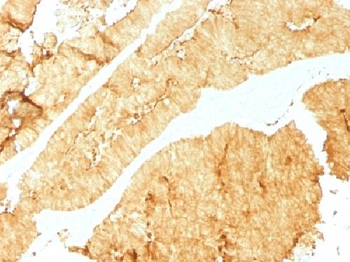 Anti-Villin Antibody