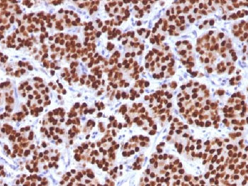 Anti-FOXA1 / HNF3A Antibody