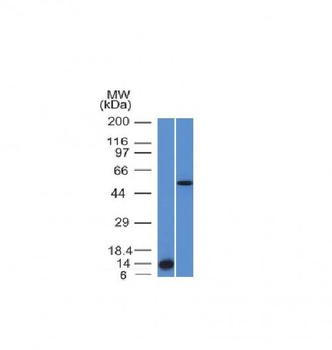 Anti-ALK (Anaplastic Lymphoma Kinase) / CD246 Antibody