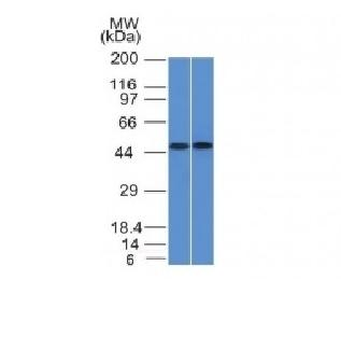 Anti-FLI1 Antibody