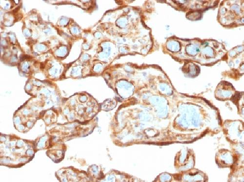 Anti-Thymidine Phosphorylase / PD-ECGF Antibody