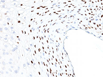 HPV-16 (Human Papilloma Virus 16) Antibody - With BSA and Azide