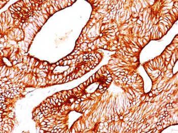 Cytokeratin 5/8 Antibody - With BSA and Azide