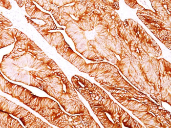 Cytokeratin 5/8 Antibody - With BSA and Azide