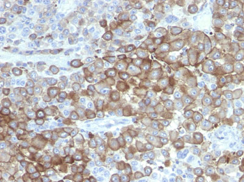 PNL2 (Melanoma Associated Antigen) Antibody - With BSA and Azide