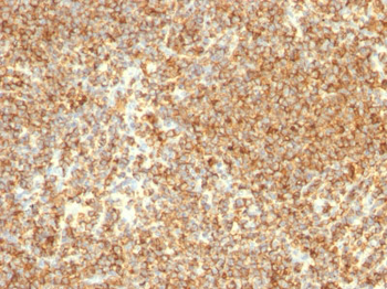 CD20 / MS4A1 (B-Cell Marker) Antibody - Culture Supernatant