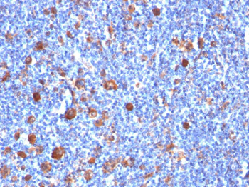 Fascin-1 (Reed-Sternberg Cell Marker) Antibody - With BSA and Azide