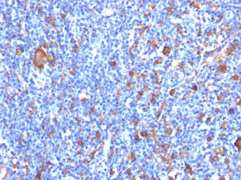 Fascin-1 (Reed-Sternberg Cell Marker) Antibody - With BSA and Azide