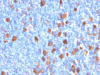 Fascin-1 (Reed-Sternberg Cell Marker) Antibody - With BSA and Azide