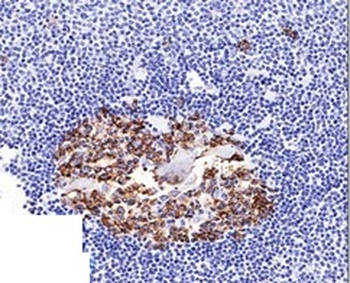 CDw75 (B-Cell Marker) Antibody - With BSA and Azide