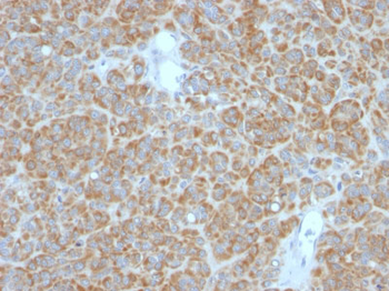Bcl-2 (Apoptosis & Follicular Lymphoma Marker) Antibody - With BSA and Azide