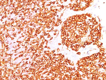 CD45RB (B-Cell Marker) Antibody - With BSA and Azide