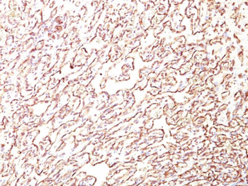 Podocalyxin (PODXL) (Hematopoietic Stem Cell Marker) Antibody - With BSA and Azide