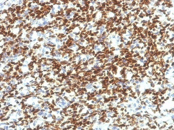 PAX7 (Rhabdomyosarcoma Marker) Antibody - With BSA and Azide