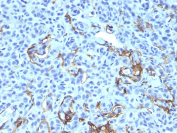 NGF-Receptor (p75) / CD271 (Soft Tissue Tumor Marker) Antibody - With BSA and Azide