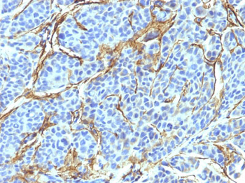 NGF-Receptor (p75) / CD271 (Soft Tissue Tumor Marker) Antibody - With BSA and Azide