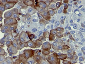 NGF-Receptor (p75) / CD271 (Soft Tissue Tumor Marker) Antibody - With BSA and Azide