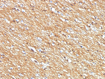CD56 / NCAM1 / NKH1 (Neuronal Cell Marker) Antibody - With BSA and Azide