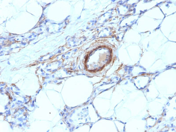 Smooth Muscle Myosin Heavy Chain (SM-MHC) (Leiomyosarcoma & Myoepithelial Cell Marker) Antibody - W