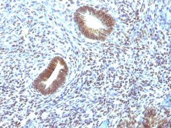 MAP3K1 (Mitogen-Activated Protein Kinase Kinase Kinase 1) Antibody - With BSA and Azide
