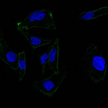 Ep-CAM / CD326 (Epithelial Marker) Antibody - With BSA and Azide