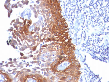 Cytokeratin 18 (KRT18) Antibody - With BSA and Azide